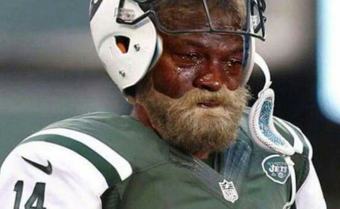 Regression to the Mean – Why Fitzpatrick is&nbsp;Sliding
